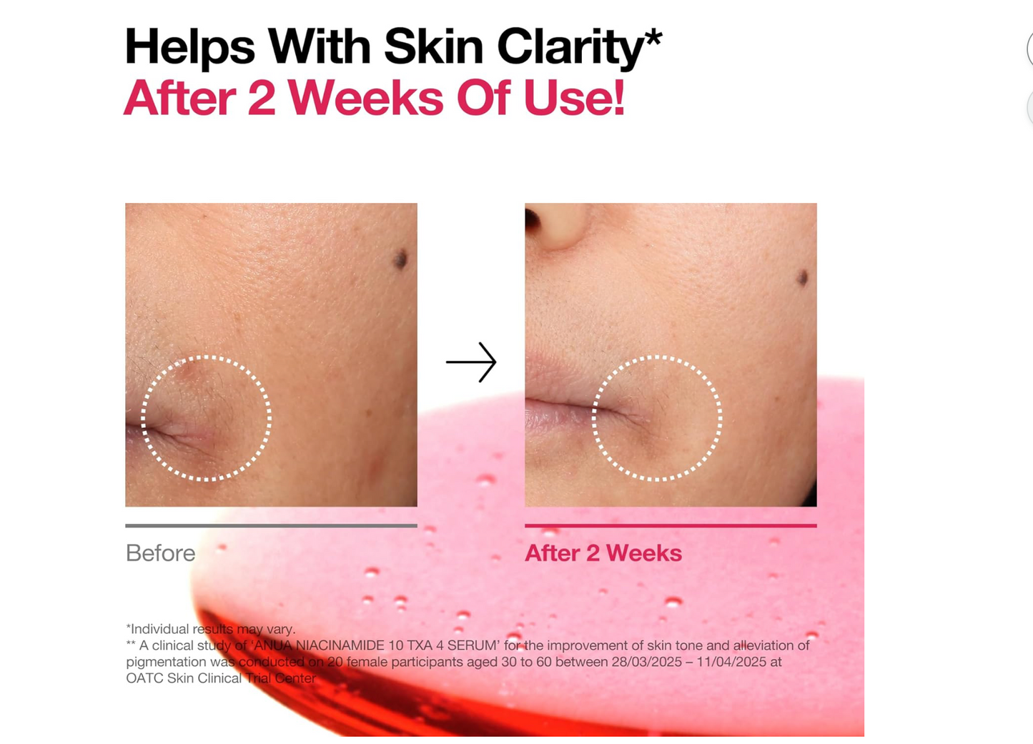 Anua 10+ Sérum Niacinamide 10% + Acide Tranexamique 4%